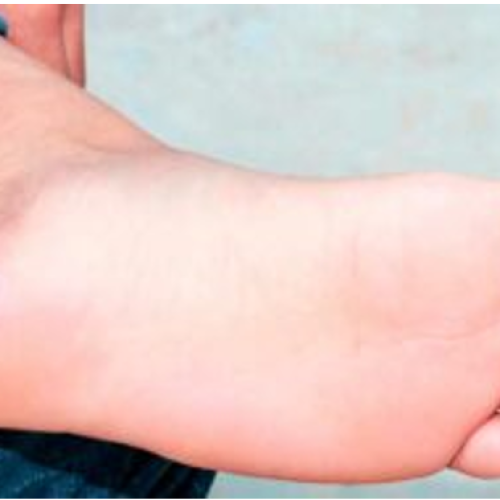 HELOMA VASCULAR